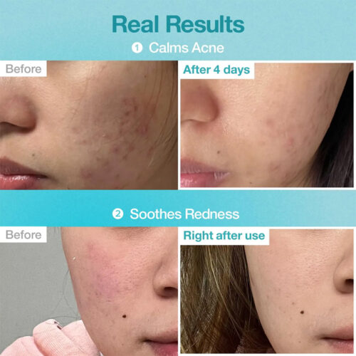 پک ماسک ورقه ای پانتوتنیک B5 و هیالورونیک اسید شماره 1 نامبوزین Numbuzin No.1 Pantothenic B5 Hyaluronic Active Clear Mask