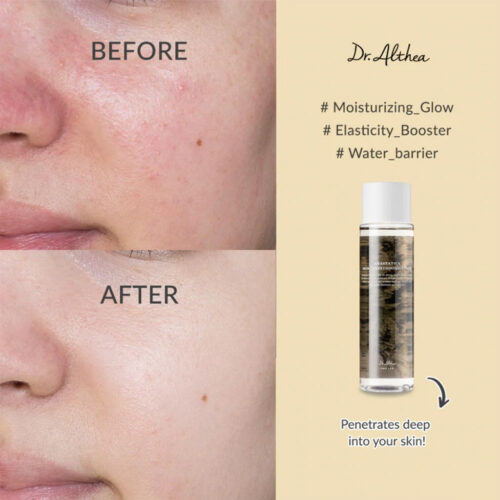 تونر تقویت کننده و آبرسان آناستاتیکا دکتر آلتیا dr.althea anastatica skin conditioning toner