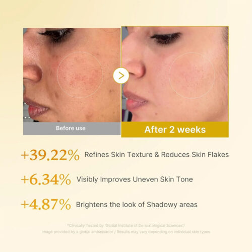 تونر ترمیم کننده و روشن کننده کوجیک اسید و زردچوبه مدی کیوب Medicube Kojic Acid Turmeric Resurfacing Toner