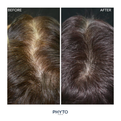قرص ریزش موی هورمونی و ارثی فیتوسیان فیتو phyto phytocyane Anti hair loss Food Supplement
