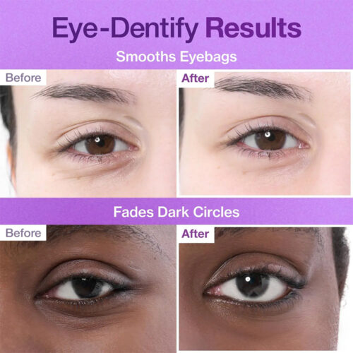 پچ زیر چشم ضد چروک و تیرگی NAD+ و کلاژن شماره 9 نامبوزین Numbuzin No.9 NAD+ Collagen Under Eye Patches